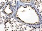 Anti-Periplakin Picoband Antibody